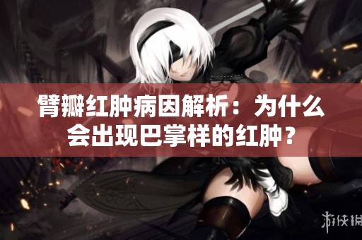 臂瓣紅腫病因解析：為什么會出現(xiàn)巴掌樣的紅腫？